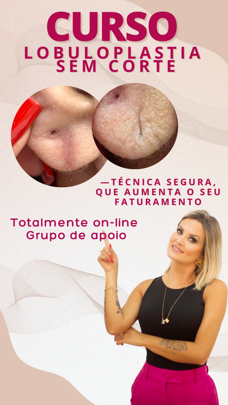 Lobuloplastia não cirúrgica curso